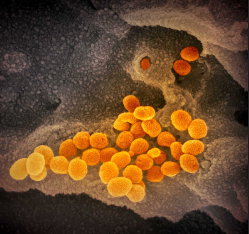Novel Coronavirus SARS-CoV-2